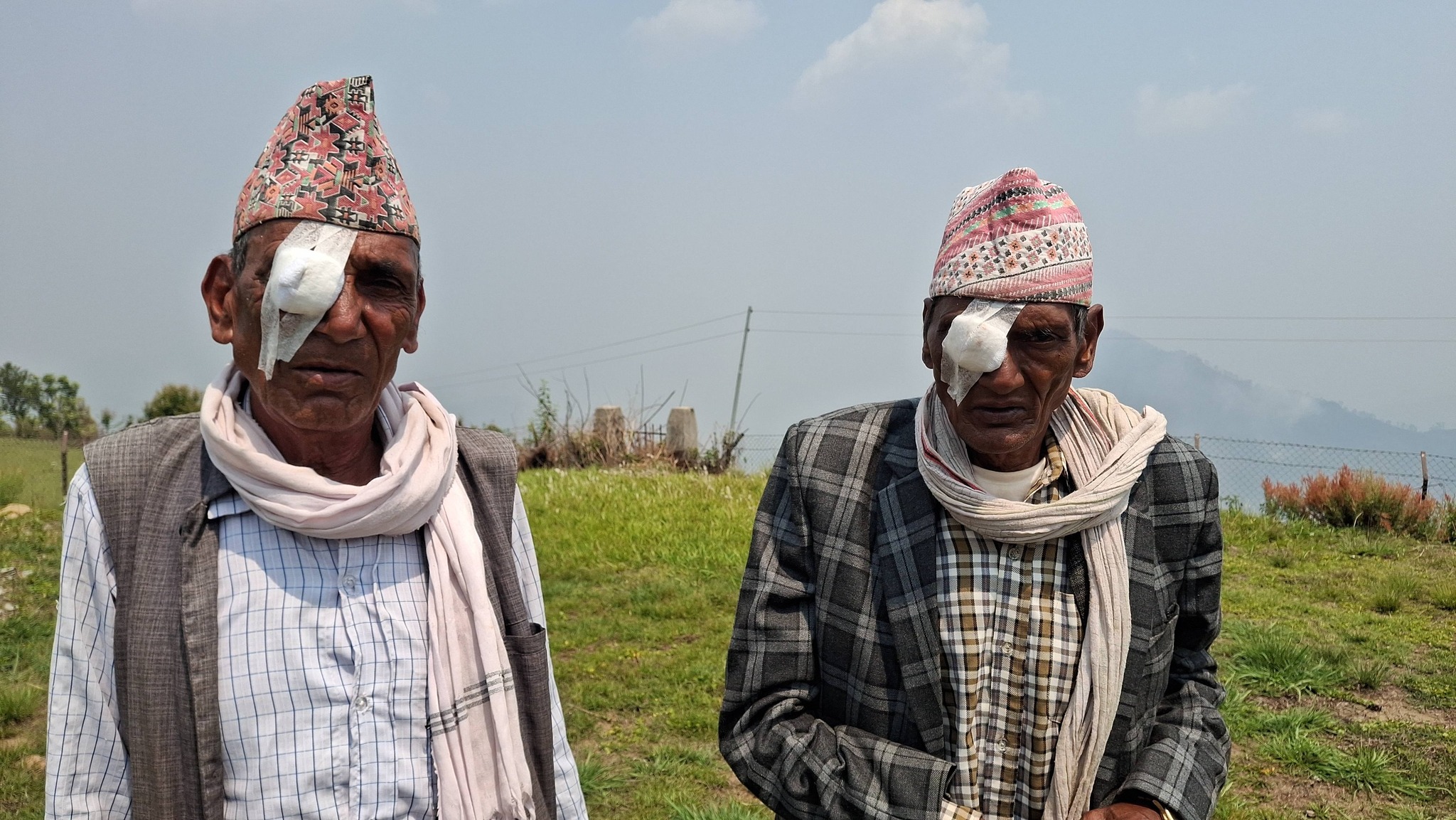 २ दिने निःशुल्क आँखा शिविरबाट ३९८ जनाले सेवा लिए, १ सय जना विरामीको मोतिबिन्दुको सफल शल्यक्रिया